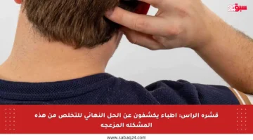قشرة الرأس: أطباء يكشفون عن الحل النهائي للتخلص من هذه المشكلة المزعجة